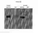 Fig. 09 - Modified Stefin A scaffold proteins