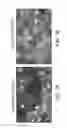 Fig. 02 - Compositions and methods for treating angiogenesis-related disorders