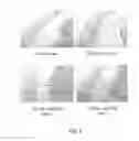 Fig. 12 - CONNECTIVE TISSUE GROWTH FACTOR ANTIBODIES
