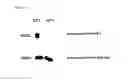Fig. 05 - HUMAN MONOCLONAL ANTIBODIES THAT NEUTRALIZE BIOACTIVITY OF GRANULOCYTE MACROPHAGE COLONY-STIMULATING FACTOR AND METHODS AND USES THEREOF