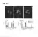 Fig. 09 - Method of imaging a cardiovascular disease with an anti-macrophage mannose receptor immunoglobulin single variable domain