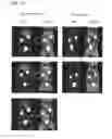 Fig. 10 - Method of imaging a cardiovascular disease with an anti-macrophage mannose receptor immunoglobulin single variable domain