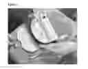 Fig. 02 - Systems and methods for tissue processing and preparation of cell suspension therefrom