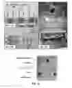 Fig. 10 - Modular bioreactor, compliance chamber for a bioreactor, and cell seeding apparatus
