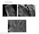 Fig. 06 - METHOD FOR FABRICATING A CELL-LADEN HYDROGEL CONSTRUCT