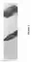 Fig. 05 - METHODS AND COMBINATION COMPRISING EUKARYOTIC CELLS AND RECOMBINANT SPIDER SILK PROTEIN