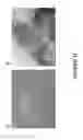 Fig. 13 - METHODS AND COMBINATION COMPRISING EUKARYOTIC CELLS AND RECOMBINANT SPIDER SILK PROTEIN