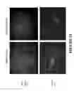 Fig. 16 - METHODS AND COMBINATION COMPRISING EUKARYOTIC CELLS AND RECOMBINANT SPIDER SILK PROTEIN