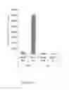 Fig. 11 - Generation of dendritic cells from monocytic dendritic precursor cells with GM-CSF in the absence of additional cytokines