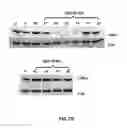 Fig. 05 - LNA antisense oligonucleotides for the modulation of Myc expression
