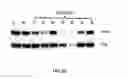 Fig. 06 - LNA antisense oligonucleotides for the modulation of Myc expression