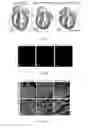 Fig. 02 - Methods for including cardiomyocyte proliferation