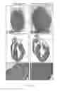 Fig. 09 - Methods for including cardiomyocyte proliferation
