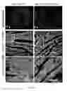 Fig. 11 - Methods for including cardiomyocyte proliferation