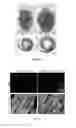 Fig. 18 - Methods for including cardiomyocyte proliferation