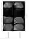 Fig. 32 - Methods for including cardiomyocyte proliferation