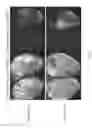 Fig. 33 - Methods for including cardiomyocyte proliferation