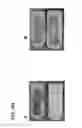 Fig. 75 - SPECIMEN COLLECTION WITH REAGENT LINED COLLECTORS