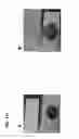 Fig. 83 - SPECIMEN COLLECTION WITH REAGENT LINED COLLECTORS