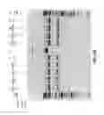 Fig. 27 - Compositions and methods of nucleic acid-targeting nucleic acids