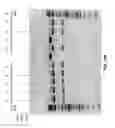 Fig. 28 - Compositions and methods of nucleic acid-targeting nucleic acids