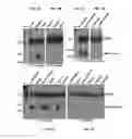 Fig. 08 - CIRCULATING SMALL NONCODING RNA MARKERS