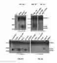 Fig. 09 - CIRCULATING SMALL NONCODING RNA MARKERS