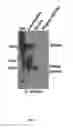 Fig. 12 - CIRCULATING SMALL NONCODING RNA MARKERS