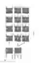 Fig. 10 - SINGLE-CELL ANALYSIS AS A SENSITIVE AND SPECIFIC METHOD FOR EARLY PROSTATE CANCER DETECTION