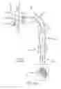 Fig. 03 - Multi-step ion implantation