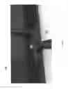 Fig. 05 - Back-Saver Snow Shovel