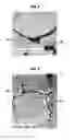 Fig. 04 - Conditioning ferrous alloys into cracking susceptible and fragmentable elements for use in a well