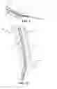 Fig. 07 - Fan blade damping device