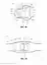 Fig. 03 - Gas dynamic valve
