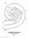 Fig. 07 - Asymmetric double-entry turbine