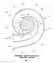 Fig. 10 - Asymmetric double-entry turbine