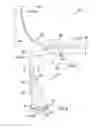 Fig. 04 - Winglet for a wind turbine rotor blade