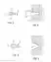 Fig. 04 - Machining process for trapezoid rings with small axial dimensions, used in pistons of internal combustion engines