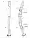 Fig. 07 - IMPROVED BOW BODY AND BOW THEREOF