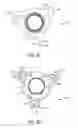 Fig. 08 - Broadhead collars