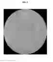 Fig. 04 - IN VITRO DETERMINATION OF SUNSCREEN PROTECTION BASED ON IMAGE ANALYSIS OF SUNSCREENS APPLIED TO SKIN