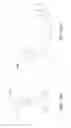 Fig. 137 - Device to determine volume of fluid dispensed