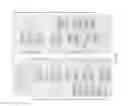 Fig. 09 - Adaptation of field use spectroscopy equipment