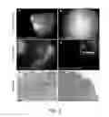 Fig. 03 - Methods and systems for spatially identifying abnormal cells