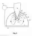 Fig. 05 - Particle concentration system