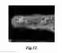 Fig. 17 - Particle concentration system