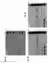 Fig. 09 - HYPOSIALYLATION DISORDERS