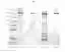 Fig. 07 - Method for the early detection of renal disease using proteomics