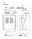 Fig. 13 - Radiation imaging apparatus and radiation imaging system