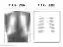 Fig. 25 - Radiation imaging apparatus and radiation imaging system